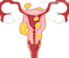 Most Experienced Adenomyosis Specialist in Ahmedabad
